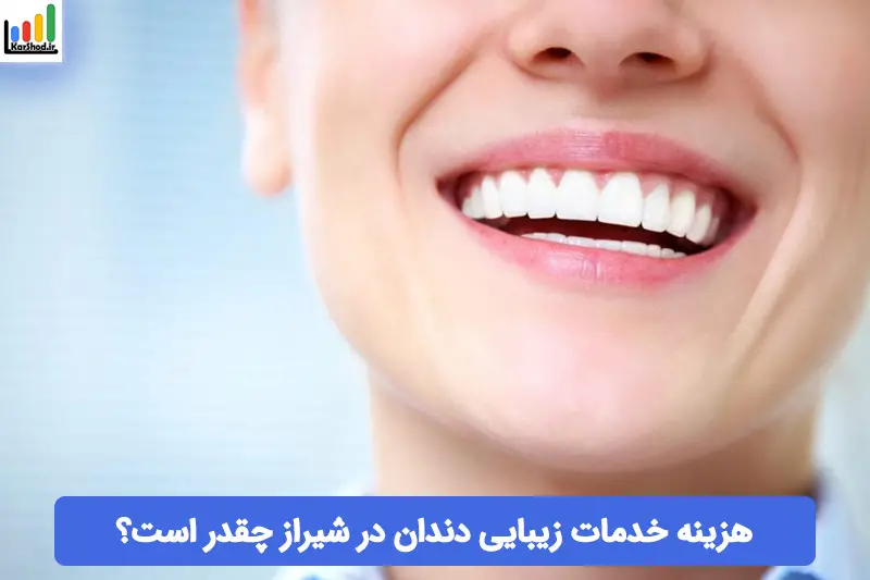 هزینه خدمات زیبایی دندان در شیراز