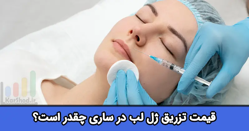 قیمت تزریق ژل لب در ساری