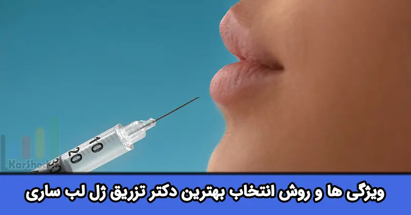 بهترین دکتر تزریق ژل لب ساری