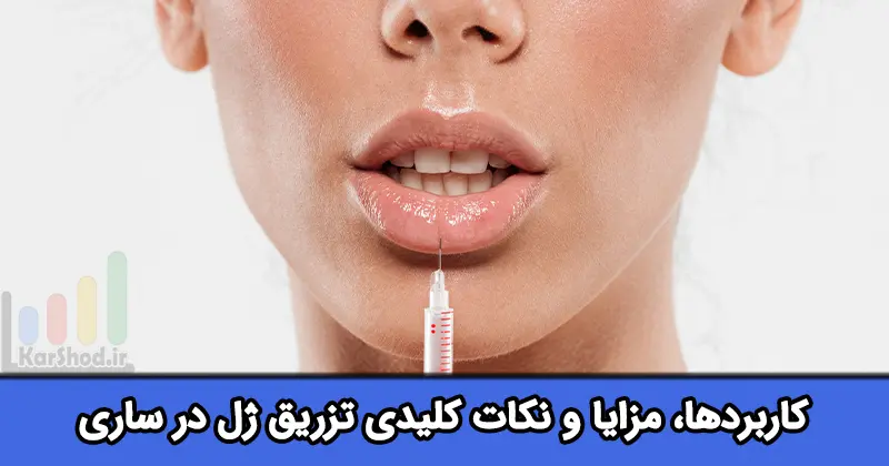 تزریق ژل در ساری