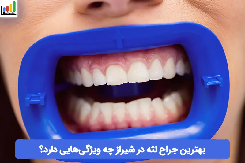بهترین جراح لثه در شیراز