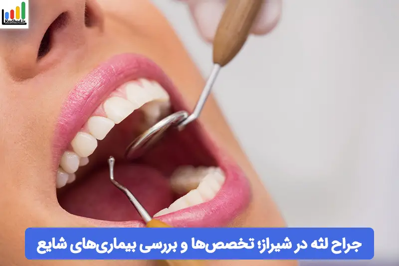 جراح لثه در شیراز