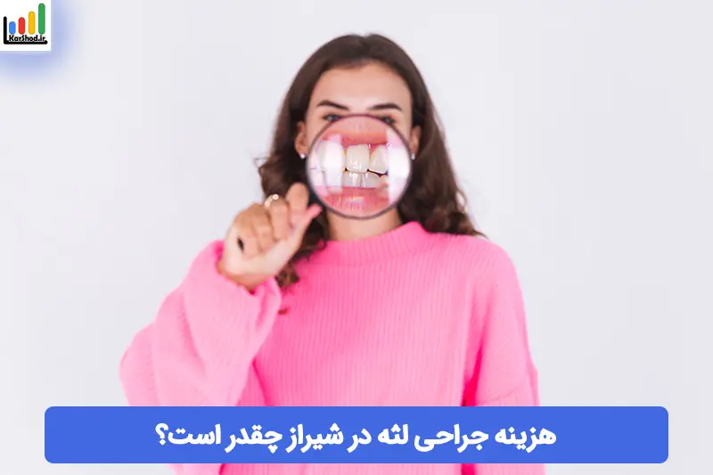هزینه جراحی لثه در شیراز