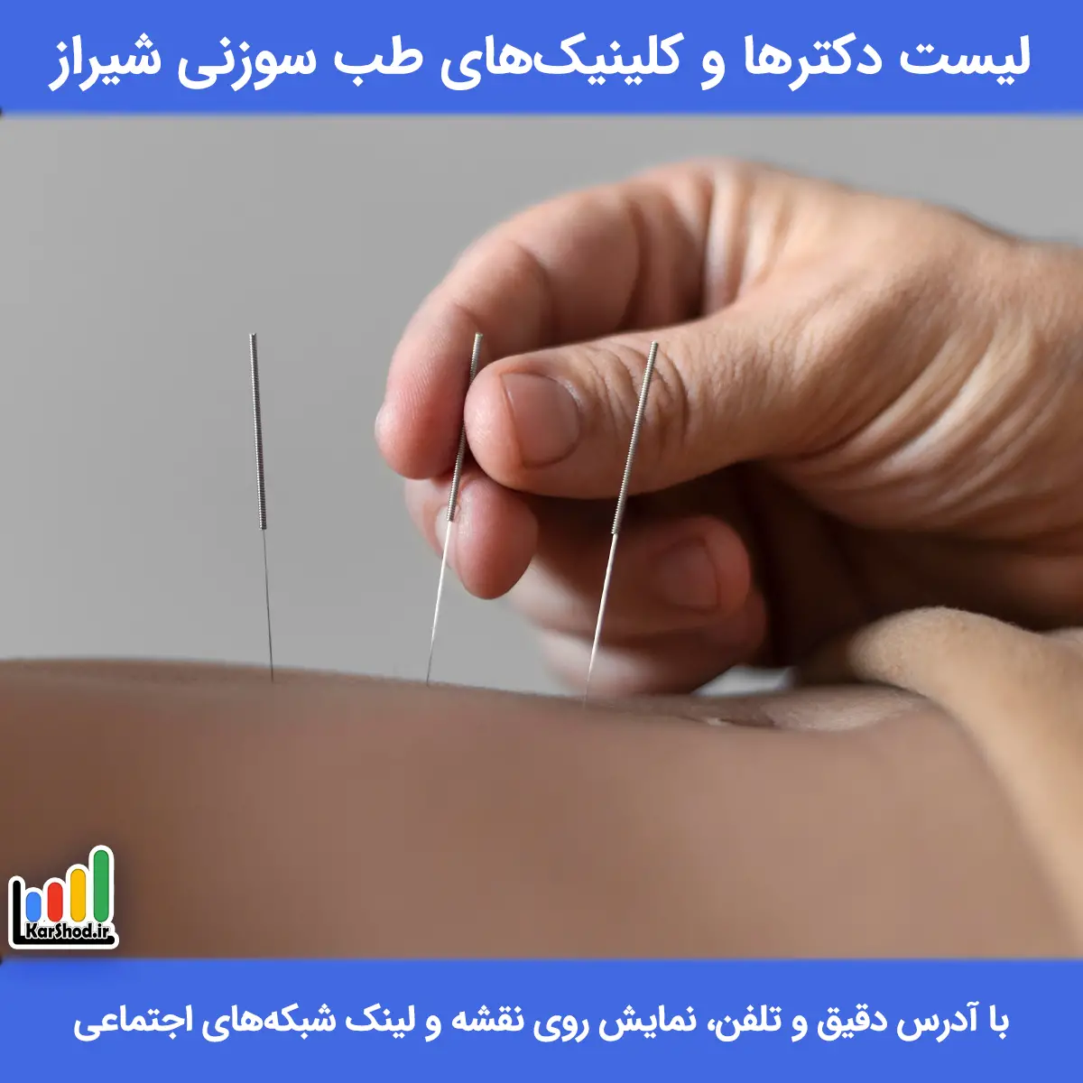 لیست مراکز طب سوزنی در شیراز همراه با آدرس و تلفن طب سوزنی شیراز