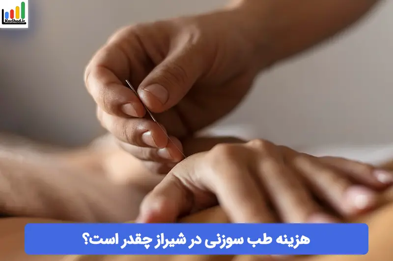 هزینه طب سوزنی در شیراز هزینه طب سوزنی در شیراز