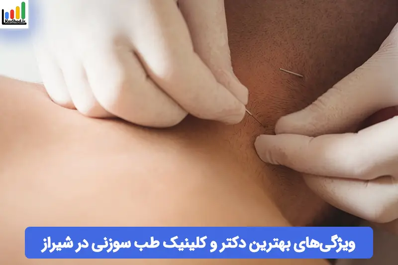 بهترین دکتر طب سوزنی در شیراز بهترین دکتر طب سوزنی در شیراز
