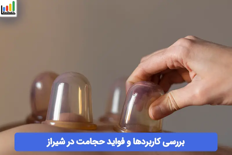 حجامت در شیراز حجامت در شیراز