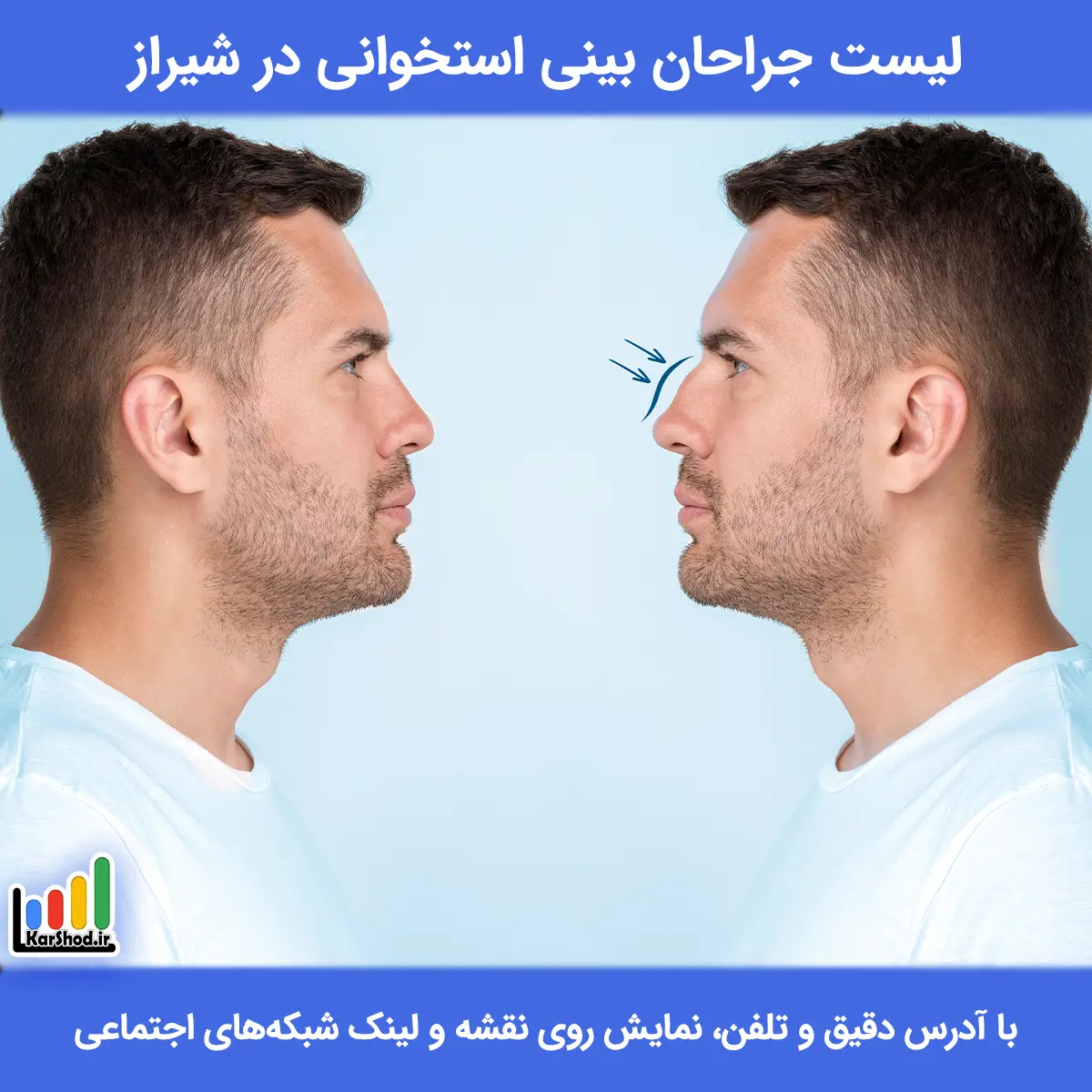 لیست جراحان بینی استخوانی در شیراز همراه با آدرس و تلفن لیست جراحان بینی استخوانی در شیراز