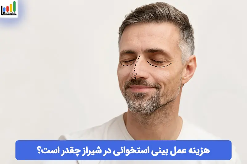 هزینه عمل بینی استخوانی در شیراز هزینه عمل بینی استخوانی در شیراز
