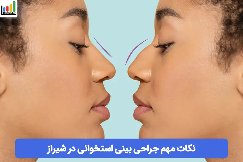 جراح بینی استخوانی در شیراز جراح بینی استخوانی در شیراز