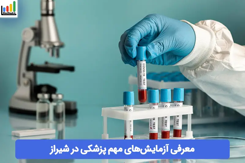 آزمایش های پزشکی در شیراز