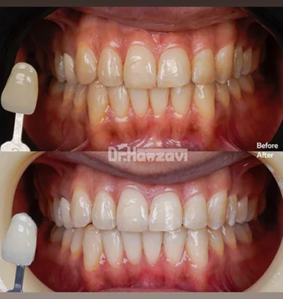 عکس های کلینیک دندانپزشکی دکتر حمزوی عکس های کلینیک دندانپزشکی دکتر حمزوی