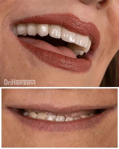 عکس های کلینیک دندانپزشکی دکتر حمزوی عکس های کلینیک دندانپزشکی دکتر حمزوی