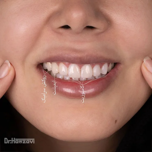 عکس های کلینیک دندانپزشکی دکتر حمزوی عکس های کلینیک دندانپزشکی دکتر حمزوی