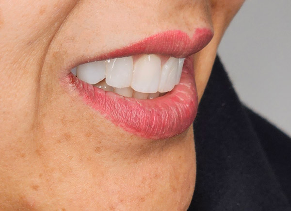 عکس های دندانپزشکی اقساطی دکتر مریم مختاری عکس های دندانپزشکی اقساطی دکتر مریم مختاری