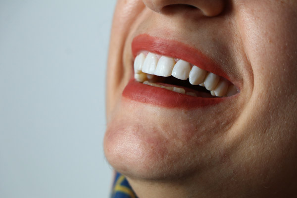 عکس های دندانپزشکی اقساطی دکتر مریم مختاری عکس های دندانپزشکی اقساطی دکتر مریم مختاری