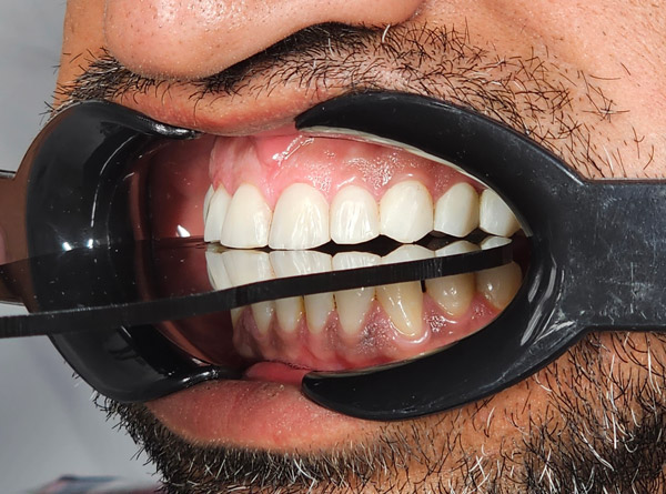 عکس های دندانپزشکی اقساطی دکتر مریم مختاری عکس های دندانپزشکی اقساطی دکتر مریم مختاری