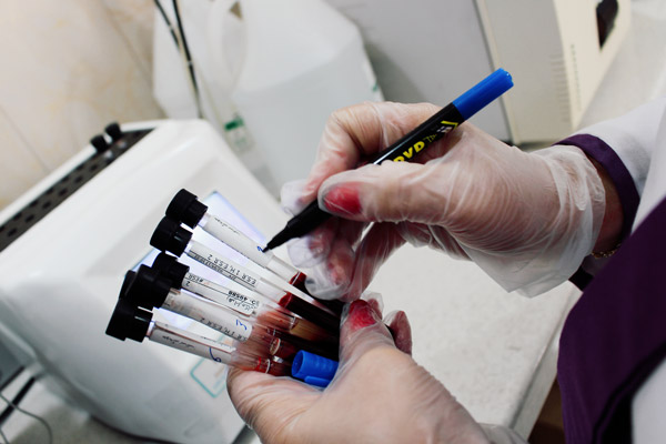 عکس های آزمایشگاه پاتوبیولوژی گیتی عکس های آزمایشگاه پاتوبیولوژی گیتی