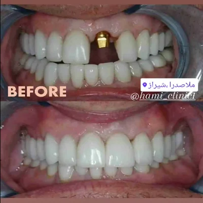 عکس های درمانگاه دندانپزشکی اقساطی حامی عکس های درمانگاه دندانپزشکی اقساطی حامی