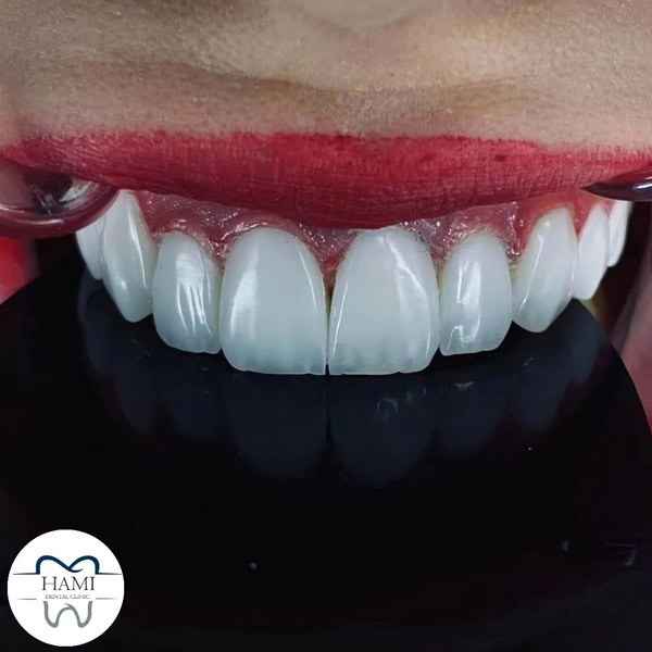 عکس های درمانگاه دندانپزشکی اقساطی حامی عکس های درمانگاه دندانپزشکی اقساطی حامی