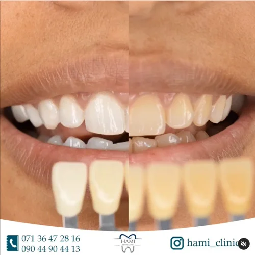 عکس های درمانگاه دندانپزشکی اقساطی حامی عکس های درمانگاه دندانپزشکی اقساطی حامی