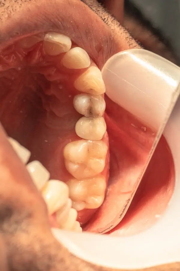 عکس های کلینیک دندانپزشکی آرت عکس های کلینیک دندانپزشکی آرت