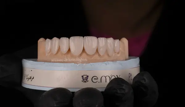 عکس های کلینیک دندانپزشکی آرت عکس های کلینیک دندانپزشکی آرت