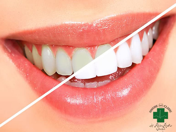 عکس های کلینیک دندانپزشکی سینوهه عکس های کلینیک دندانپزشکی سینوهه