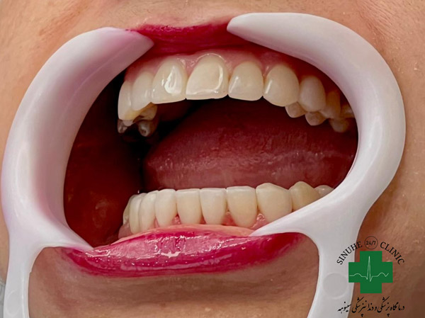 عکس های کلینیک دندانپزشکی سینوهه عکس های کلینیک دندانپزشکی سینوهه