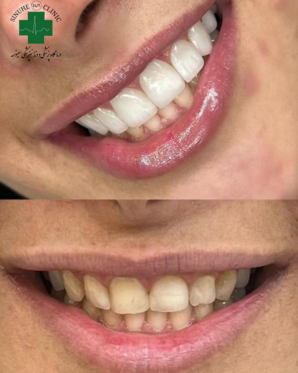 عکس های کلینیک دندانپزشکی سینوهه عکس های کلینیک دندانپزشکی سینوهه