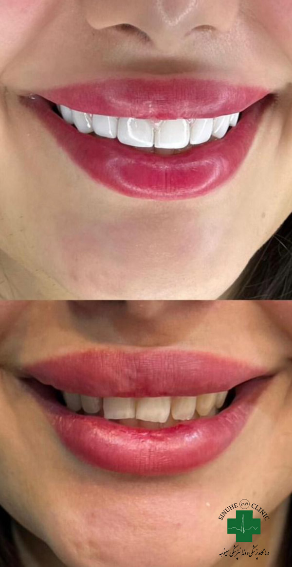 عکس های کلینیک دندانپزشکی سینوهه عکس های کلینیک دندانپزشکی سینوهه