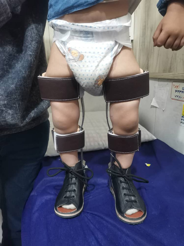 عکس های ارتوپدی فنی توان بخش عکس های ارتوپدی فنی توان بخش