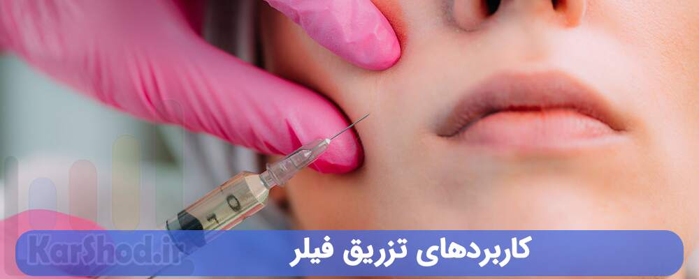 کاربرد های تزریق فیلر در شیراز