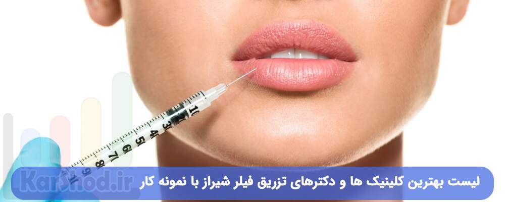 لیست بهترین کلینیک ها و دکترهای تزریق فیلر شیراز