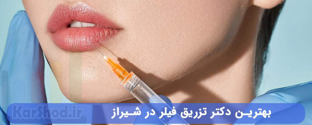 بهترین دکتر تزریق فیلر در شیراز