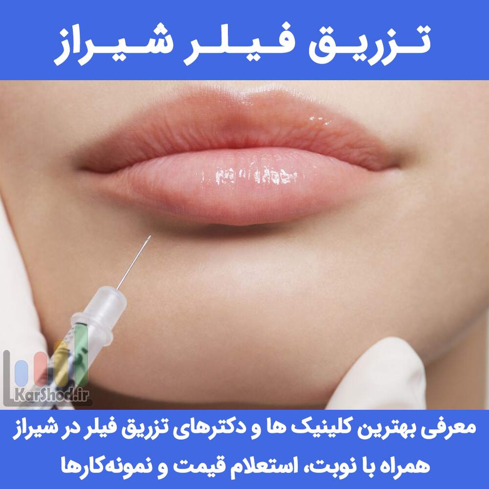 تزریق فیلر شیراز