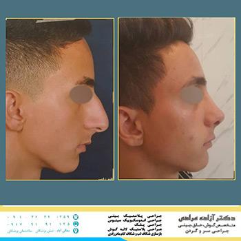 عکس های دکتر آزاده مرادی عکس های دکتر آزاده مرادی