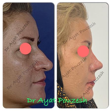 عکس های دکتر آیت پوزش عکس های دکتر آیت پوزش