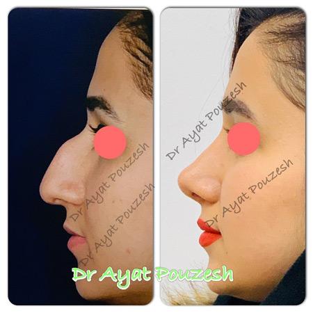 عکس های دکتر آیت پوزش عکس های دکتر آیت پوزش