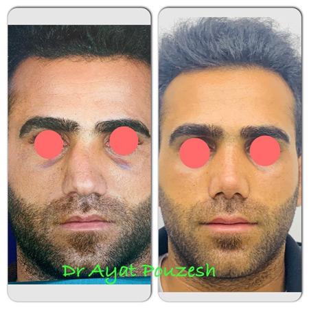 عکس های دکتر آیت پوزش عکس های دکتر آیت پوزش