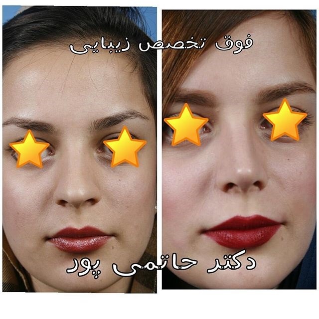 نمونه کارهای دکتر ابراهیم حاتمی پور شیراز نمونه کارهای دکتر ابراهیم حاتمی پور شیراز