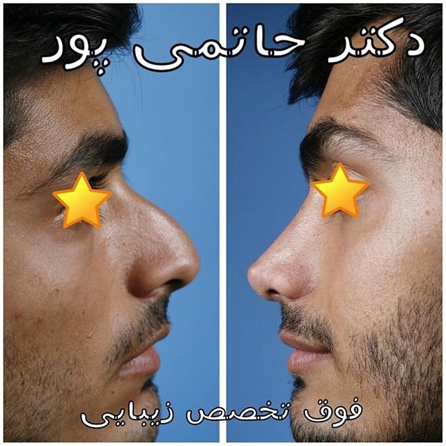 نمونه کاری از دکتر ابراهیم حاتمی پور شیراز نمونه کاری از دکتر ابراهیم حاتمی پور شیراز