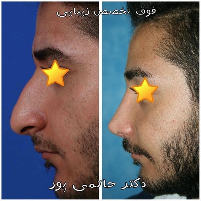 نمونه کارهای دکتر ابراهیم حاتمی پور شیراز نمونه کارهای دکتر ابراهیم حاتمی پور شیراز