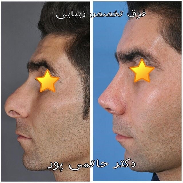 نمونه کاری از دکتر ابراهیم حاتمی پور شیراز نمونه کاری از دکتر ابراهیم حاتمی پور شیراز