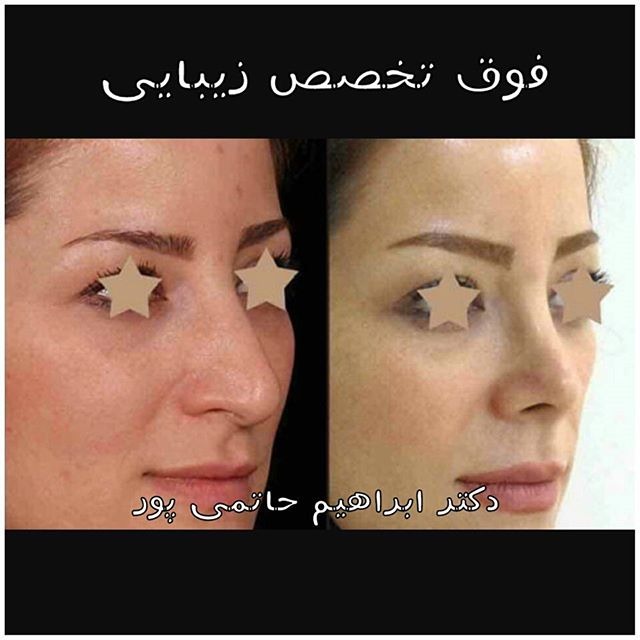 نمونه کار دکتر ابراهیم حاتمی پور شیراز نمونه کار دکتر ابراهیم حاتمی پور شیراز
