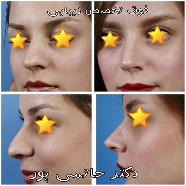 نمونه کارهای دکتر ابراهیم حاتمی پور شیراز نمونه کارهای دکتر ابراهیم حاتمی پور شیراز