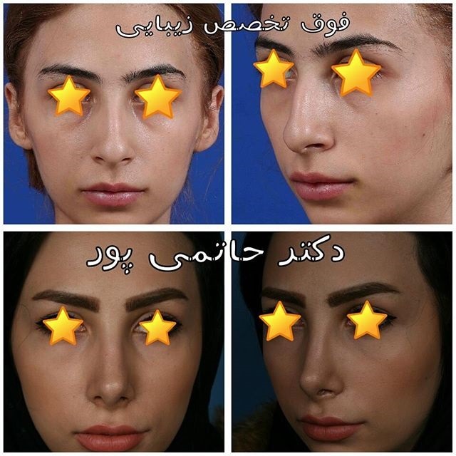 نمونه کار دکتر ابراهیم حاتمی پور شیراز نمونه کار دکتر ابراهیم حاتمی پور شیراز