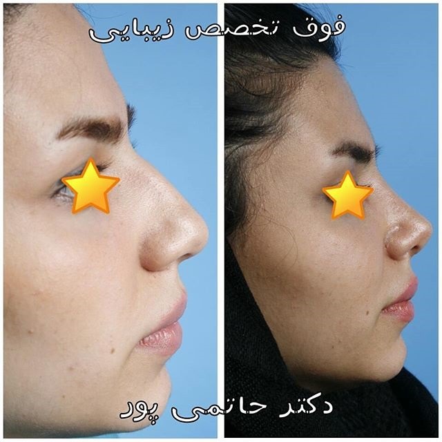 Photo ofDr. Ebrahim Hatamipour  Photo ofDr. Ebrahim Hatamipour