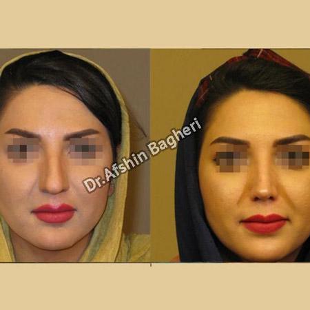 عکس های دکتر افشین باقری عکس های دکتر افشین باقری