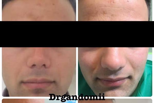 عکس های دکتر بهروز گندمی عکس های دکتر بهروز گندمی